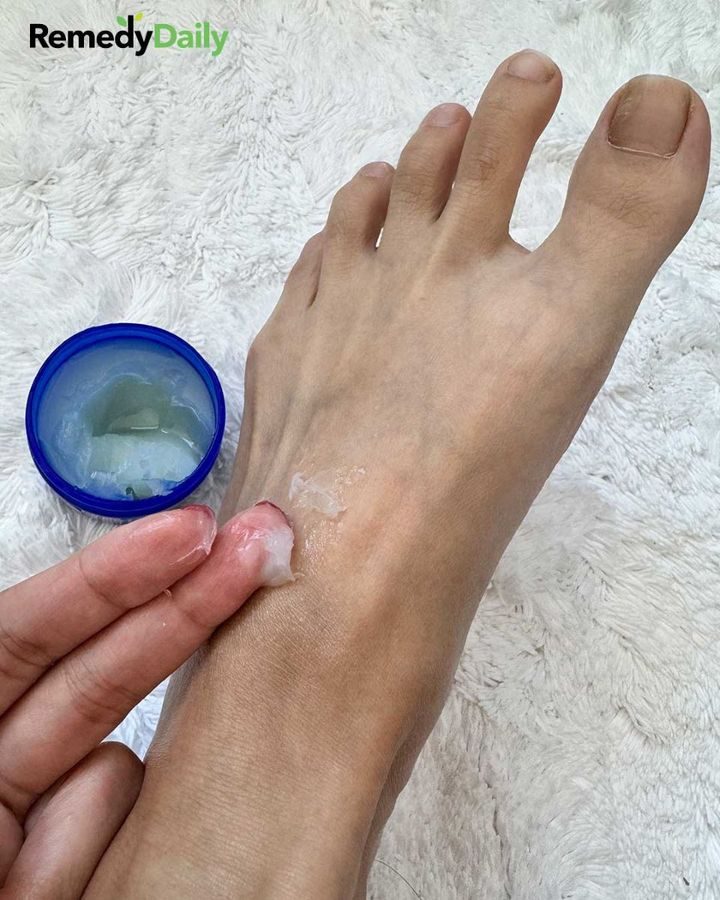 Kobieta wciera sobie w stopy Vicks Vaporub przed snem z tego genialnego powodu