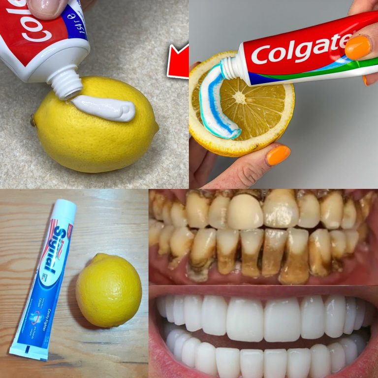 Naturalna mieszanka do wybielania żółtych zębów w domu w jeden dzień