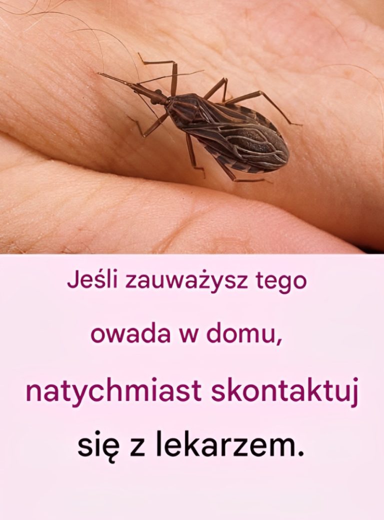 Ten niewielki, mało znany owad jest bardzo niebezpieczny, nie zbliżaj się do niego