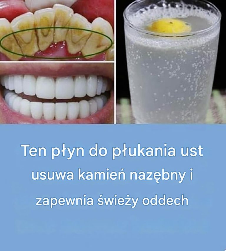 Naturalny sposób na czyste i białe zęby